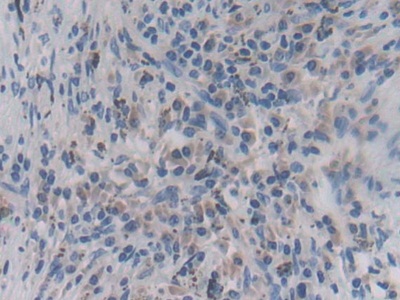 Polyclonal Antibody to Interferon Epsilon (IFNe)