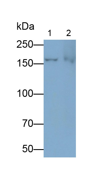 Polyclonal Antibody to Glycogen Debranching Enzyme (AGL)