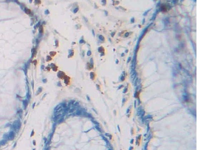 Polyclonal Antibody to Ribonuclease A8 (RNASE8)