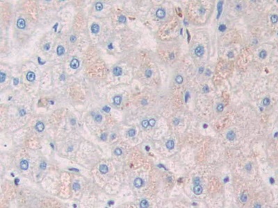 Polyclonal Antibody to Ribonuclease A8 (RNASE8)