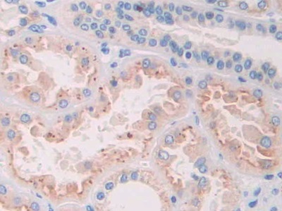 Polyclonal Antibody to Ribonuclease A8 (RNASE8)