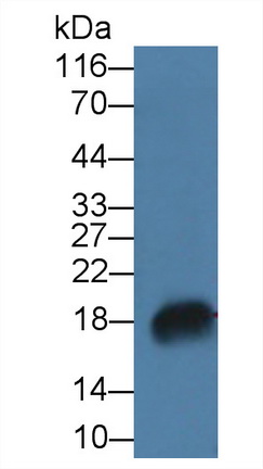 Polyclonal Antibody to Ribonuclease A7 (RNASE7)