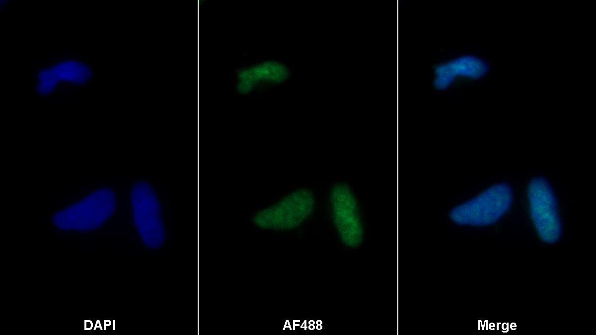 Polyclonal Antibody to Ribonuclease A7 (RNASE7)