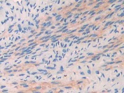 Polyclonal Antibody to Collagen Type II Alpha 1 (COL2a1)