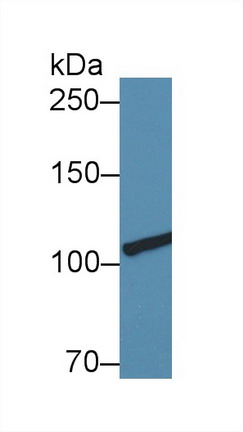 Polyclonal Antibody to Collagen Type III Alpha 1 (COL3a1)