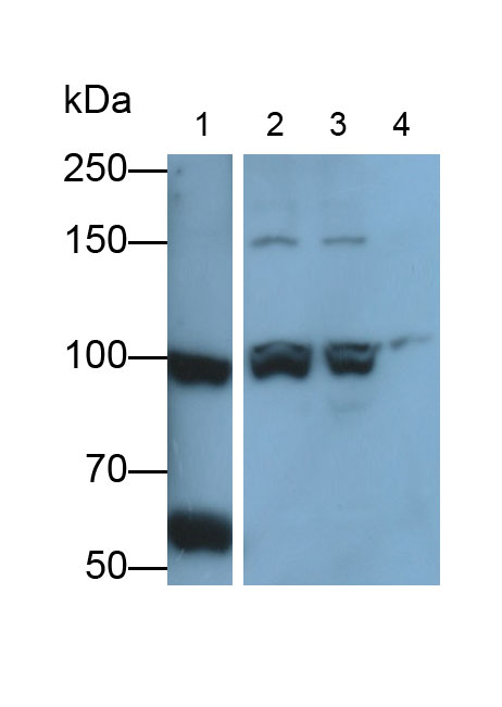 Polyclonal Antibody to Collagen Type III Alpha 1 (COL3a1)