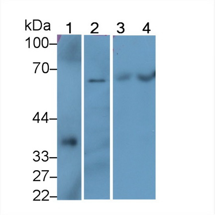 Polyclonal Antibody to Sequestosome 1 (SQSTM1)