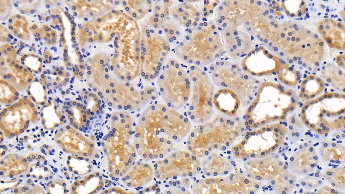 Polyclonal Antibody to Sequestosome 1 (SQSTM1)