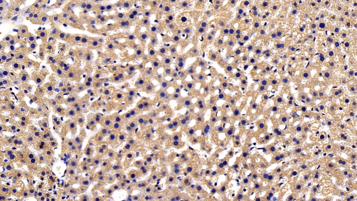 Polyclonal Antibody to Sequestosome 1 (SQSTM1)