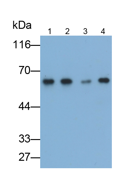 Polyclonal Antibody to Sequestosome 1 (SQSTM1)
