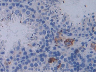 Polyclonal Antibody to Epstein Barr Virus Induced Protein 3 (EBI3)