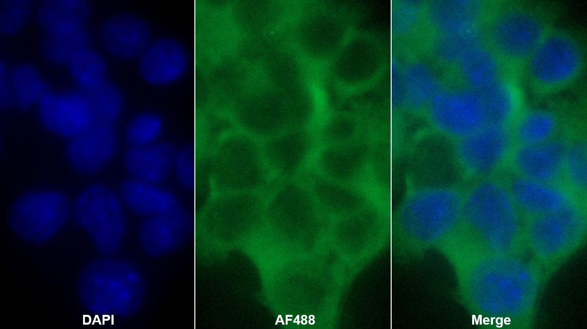 Polyclonal Antibody to Complement Component 1, Q Subcomponent A (C1qA)