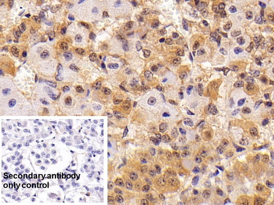 Polyclonal Antibody to Thyroid Stimulating Hormone Beta (TSHb)