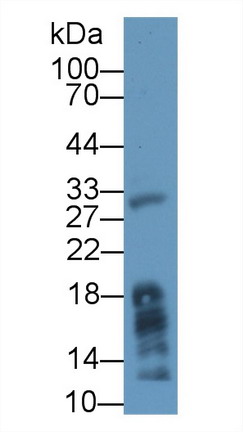 Polyclonal Antibody to Lipase, Monoacylglycerol (MGL)