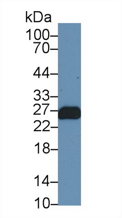 Polyclonal Antibody to Troponin I Type 1, Slow Skeletal (TNNI1)