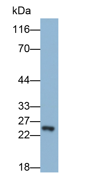 Polyclonal Antibody to Troponin I Type 1, Slow Skeletal (TNNI1)