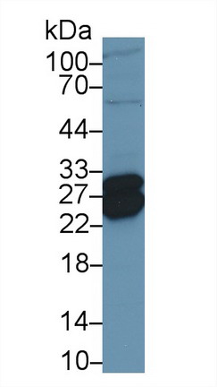 Polyclonal Antibody to Troponin I Type 1, Slow Skeletal (TNNI1)