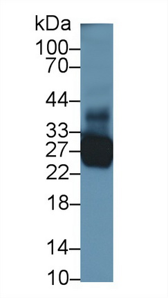 Polyclonal Antibody to Troponin I Type 1, Slow Skeletal (TNNI1)