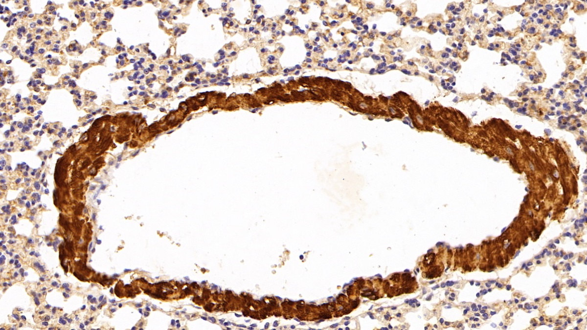 Polyclonal Antibody to Troponin T Type 2, Cardiac (TNNT2)