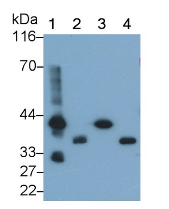 Polyclonal Antibody to Troponin T Type 2, Cardiac (TNNT2)