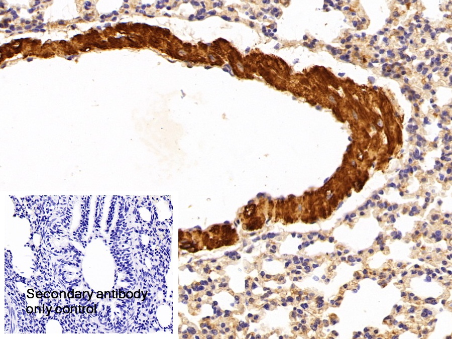 Polyclonal Antibody to Troponin T Type 2, Cardiac (TNNT2)