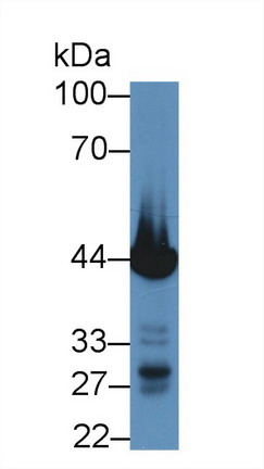 Polyclonal Antibody to Troponin T Type 2, Cardiac (TNNT2)