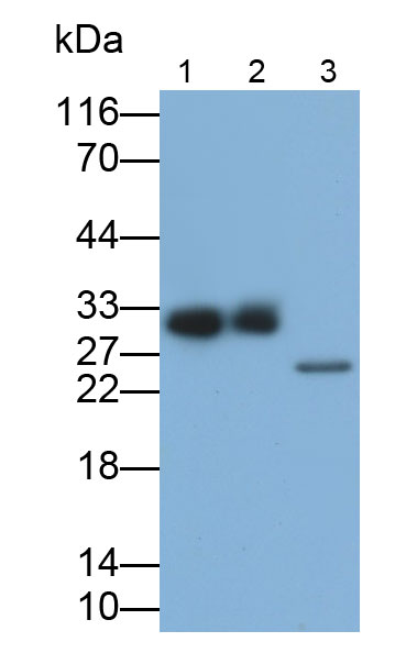 Polyclonal Antibody to Troponin T Type 3, Fast Skeletal (TNNT3)