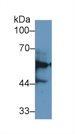 Polyclonal Antibody to Keratin 6A (KRT6A)