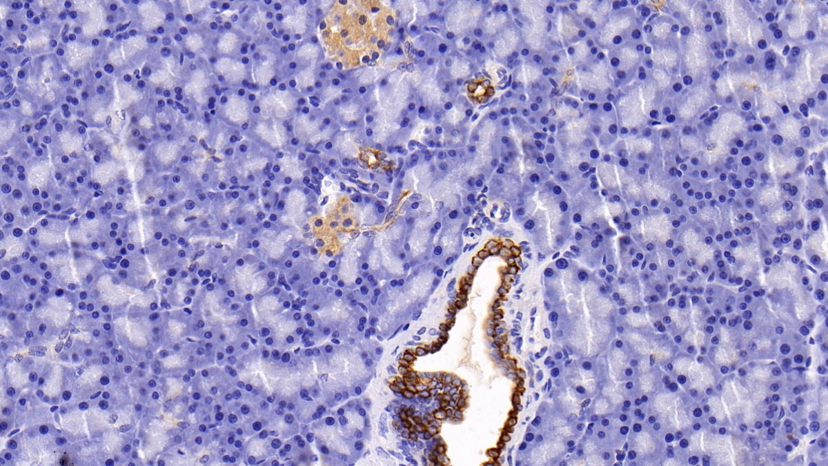 Polyclonal Antibody to Keratin 6A (KRT6A)