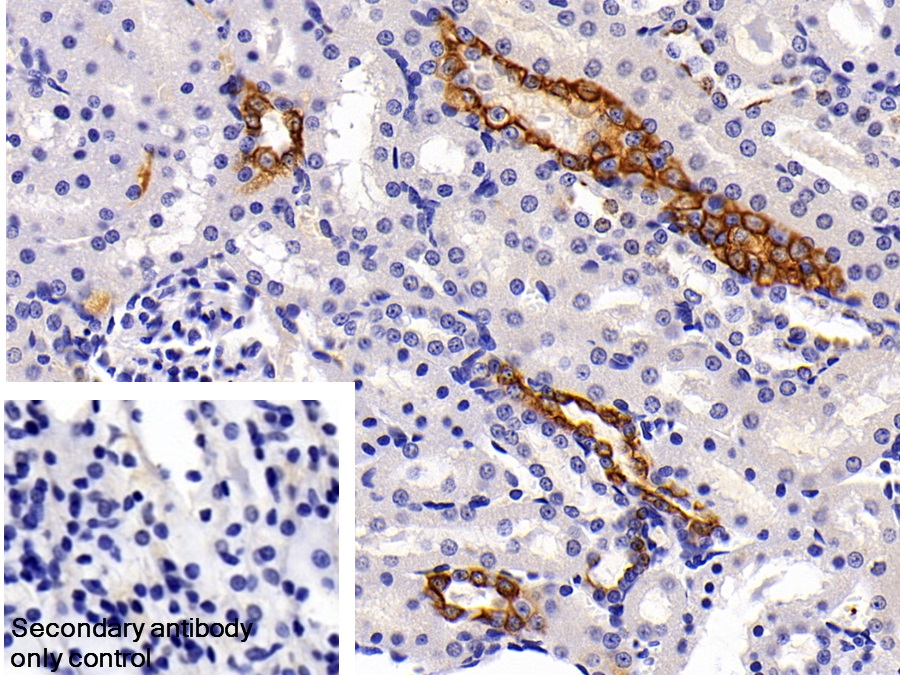 Polyclonal Antibody to Keratin 6A (KRT6A)