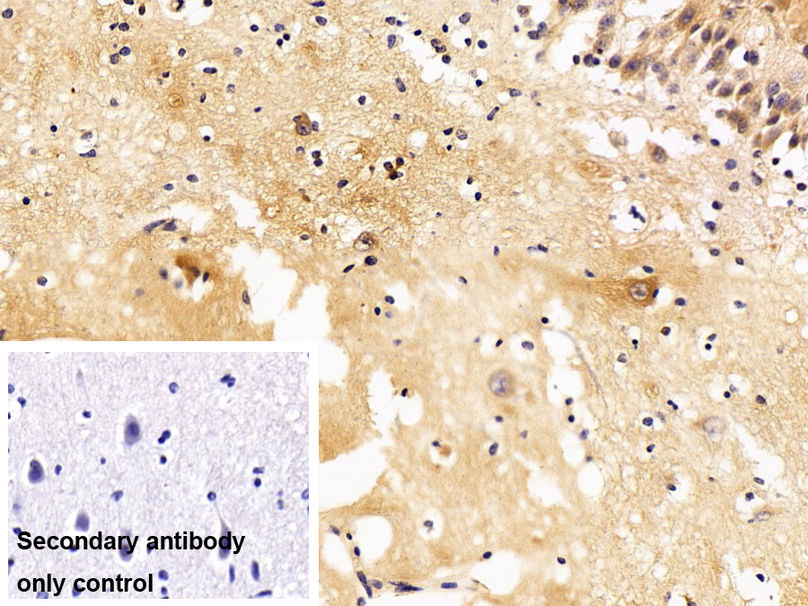 Polyclonal Antibody to Leukotriene A4 Hydrolase (LTA4H)