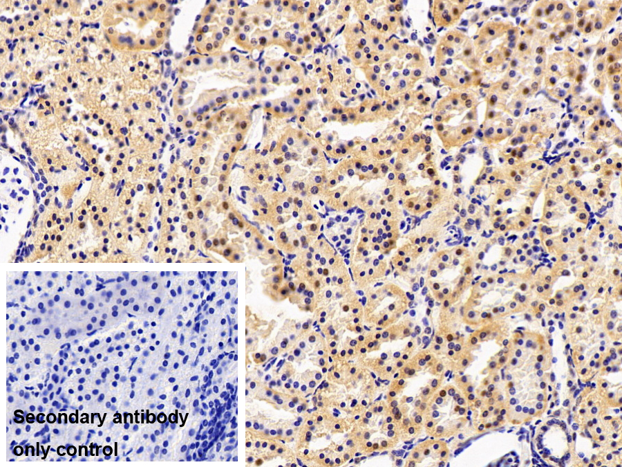 Polyclonal Antibody to Leukotriene A4 Hydrolase (LTA4H)
