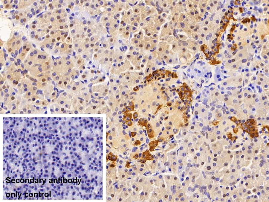 Polyclonal Antibody to Leukotriene A4 Hydrolase (LTA4H)