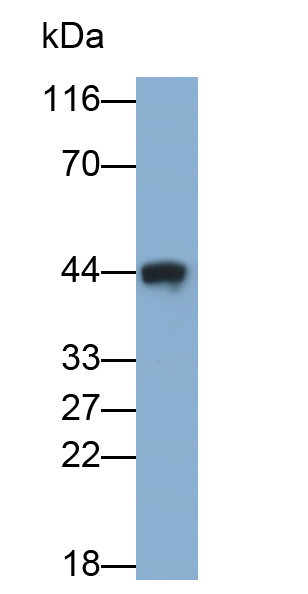Polyclonal Antibody to Ataxin 3 (ATXN3)