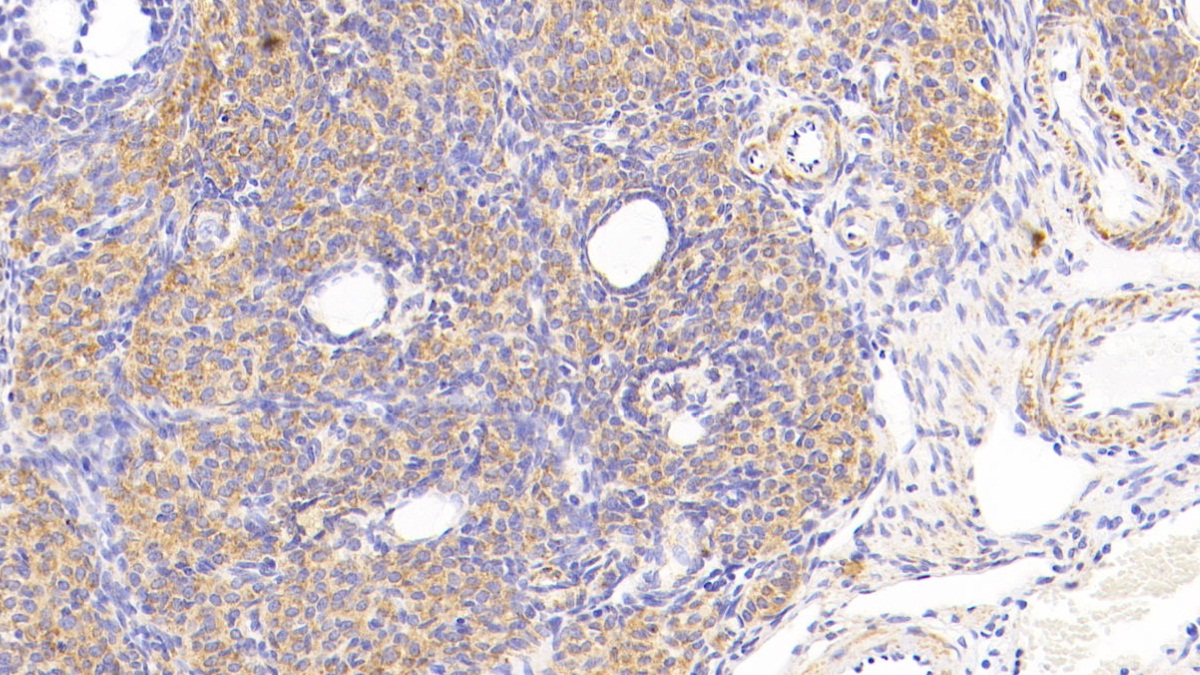 Polyclonal Antibody to Cytochrome C Oxidase Subunit II (COX2)