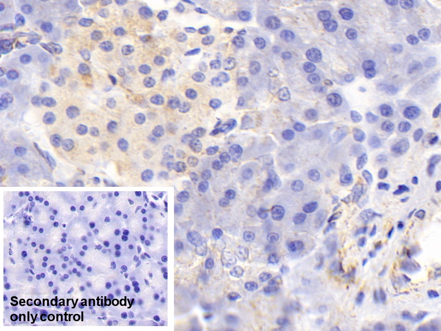 Polyclonal Antibody to Cytochrome C Oxidase Subunit II (COX2)