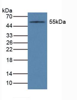 Polyclonal Antibody to Cytochrome P450 1A1 (CYP1A1)