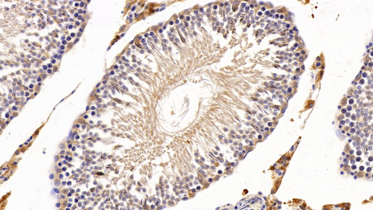 Polyclonal Antibody to Cytochrome P450 1A1 (CYP1A1)