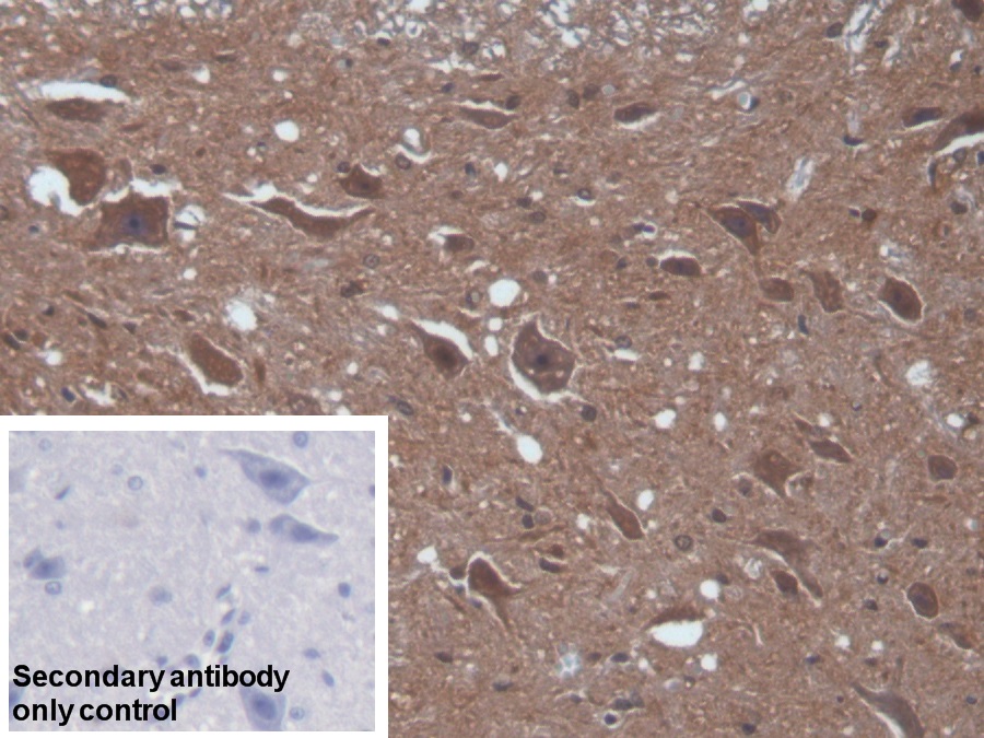 Polyclonal Antibody to Calcium/Calmodulin Dependent Protein Kinase II Alpha (CAMK2a)