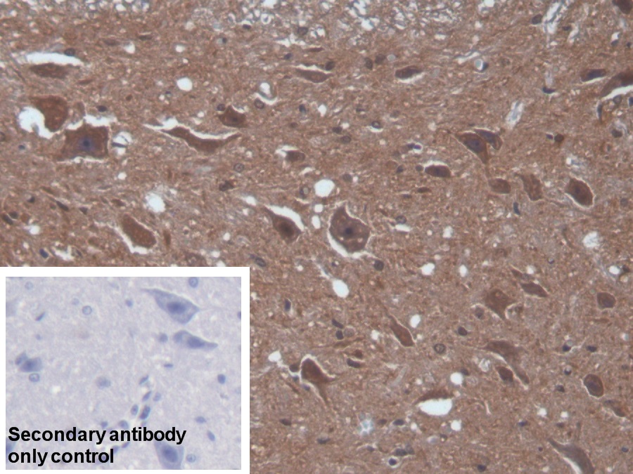 Polyclonal Antibody to Calcium/Calmodulin Dependent Protein Kinase II Alpha (CAMK2a)