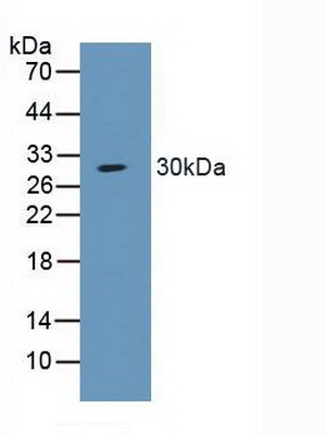 Polyclonal Antibody to Amiloride Sensitive Sodium Channel Subunit Alpha (SCNN1a)