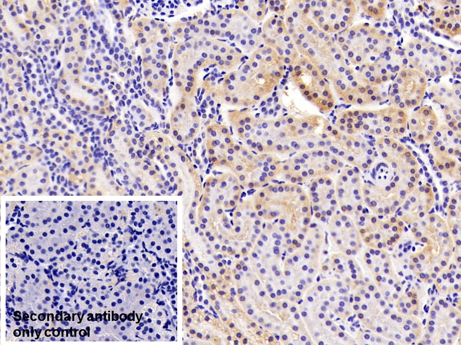 Polyclonal Antibody to Amiloride Sensitive Sodium Channel Subunit Alpha (SCNN1a)