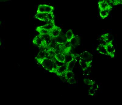 Polyclonal Antibody to Hexokinase 2 (HK2)