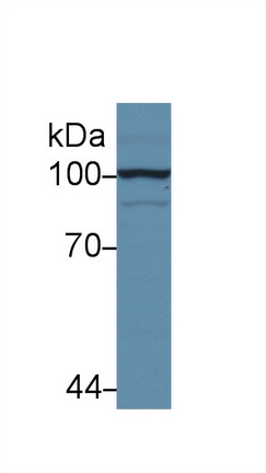 Polyclonal Antibody to Hexokinase 2 (HK2)