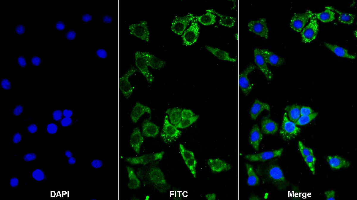 Polyclonal Antibody to Leukocyte Elastase Inhibitor (LEI)