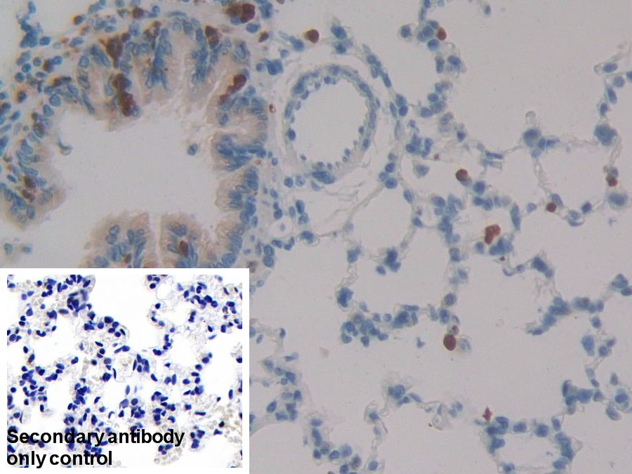 Polyclonal Antibody to Leukocyte Elastase Inhibitor (LEI)