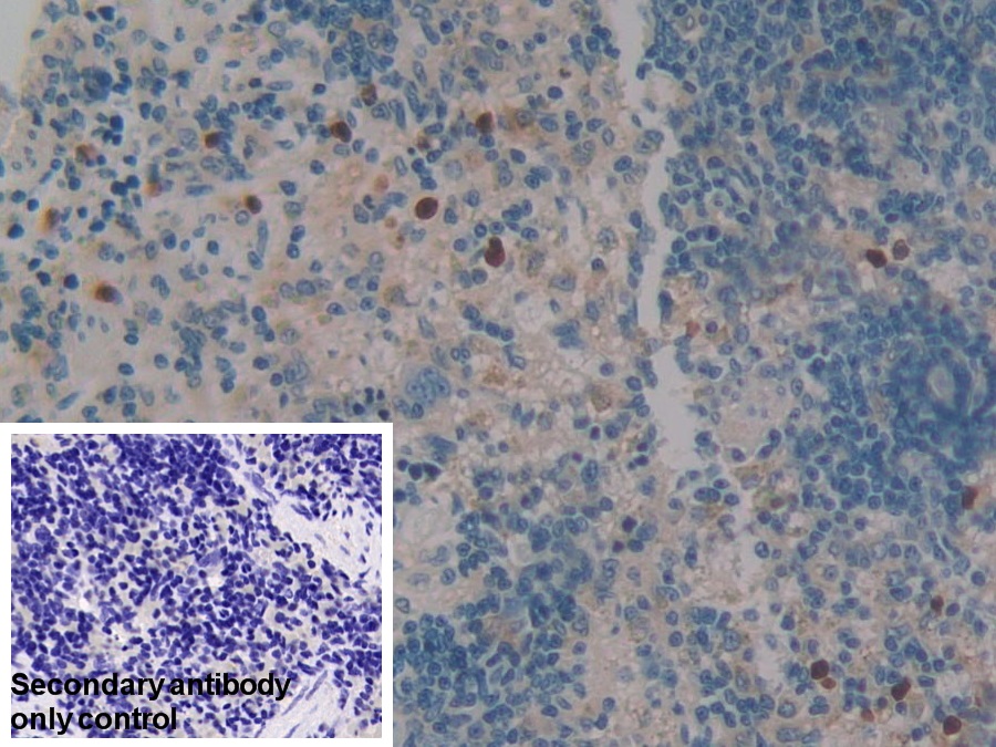 Polyclonal Antibody to Leukocyte Elastase Inhibitor (LEI)