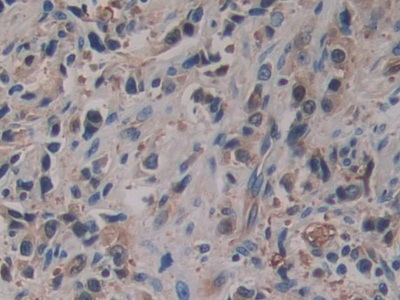 Polyclonal Antibody to Placental Thrombin Inhibitor (PTI)
