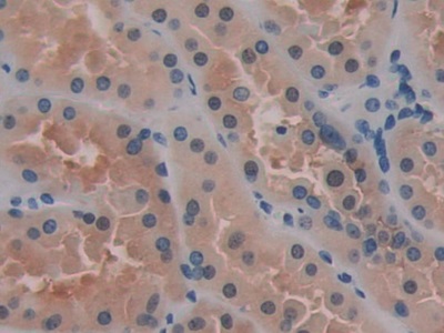 Polyclonal Antibody to Placental Thrombin Inhibitor (PTI)