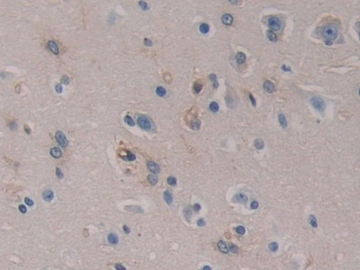 Polyclonal Antibody to Placental Thrombin Inhibitor (PTI)